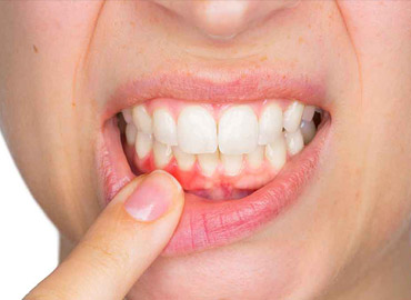 أمراض الأسنان والجراحة