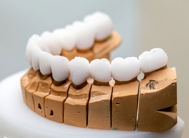علاج الأسنان الاصطناعية